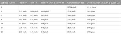 Towards automated video-based assessment of dystonia in dyskinetic cerebral palsy: A novel approach using markerless motion tracking and machine learning